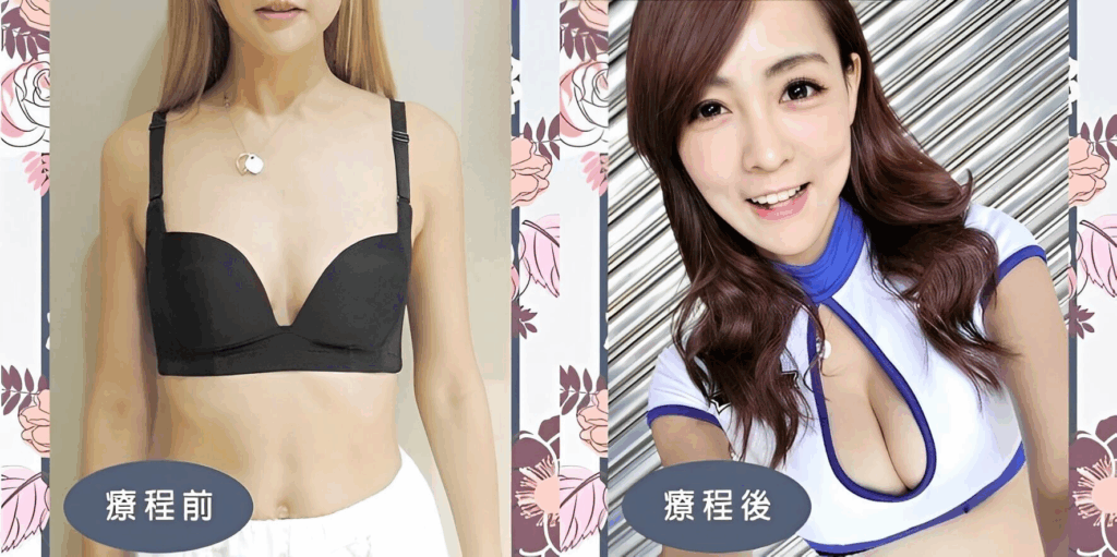 療程前VS 療程後