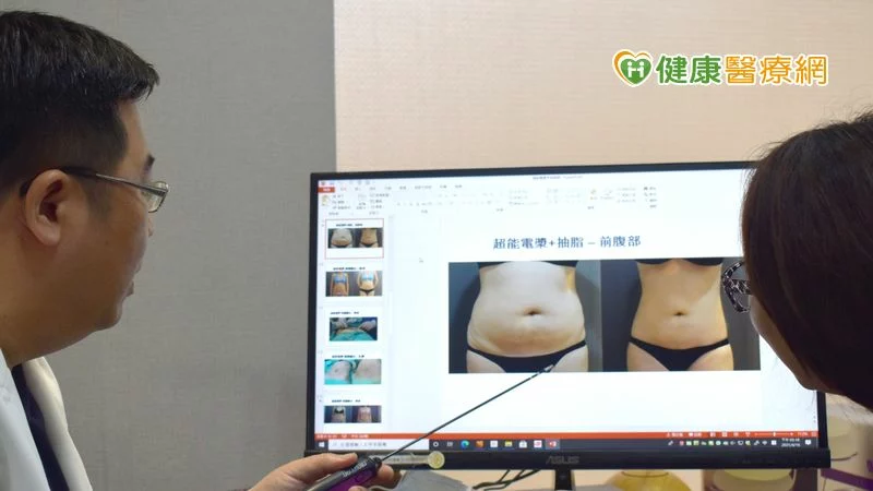 傳統抽脂手術 常有贅皮或凹凸不平後遺症