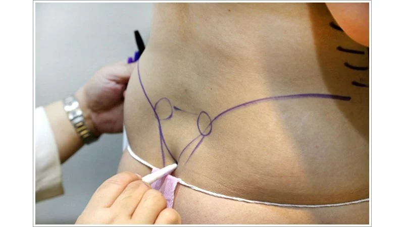 院長術前諮詢標記