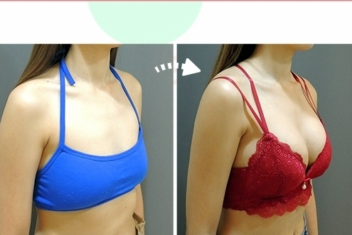 雙面蜜桃絨隆乳 (果凍矽膠)1