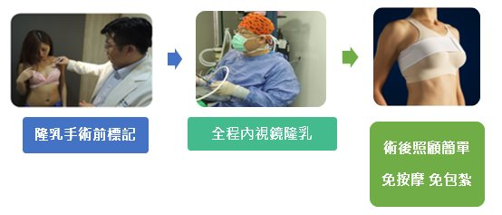 巨星醫美診所 隆乳手術標準流程2