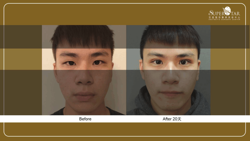 Case 9：大學生了沒 - 顧小瑋