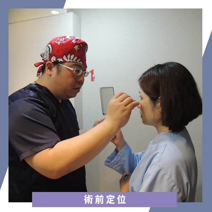 術前定位