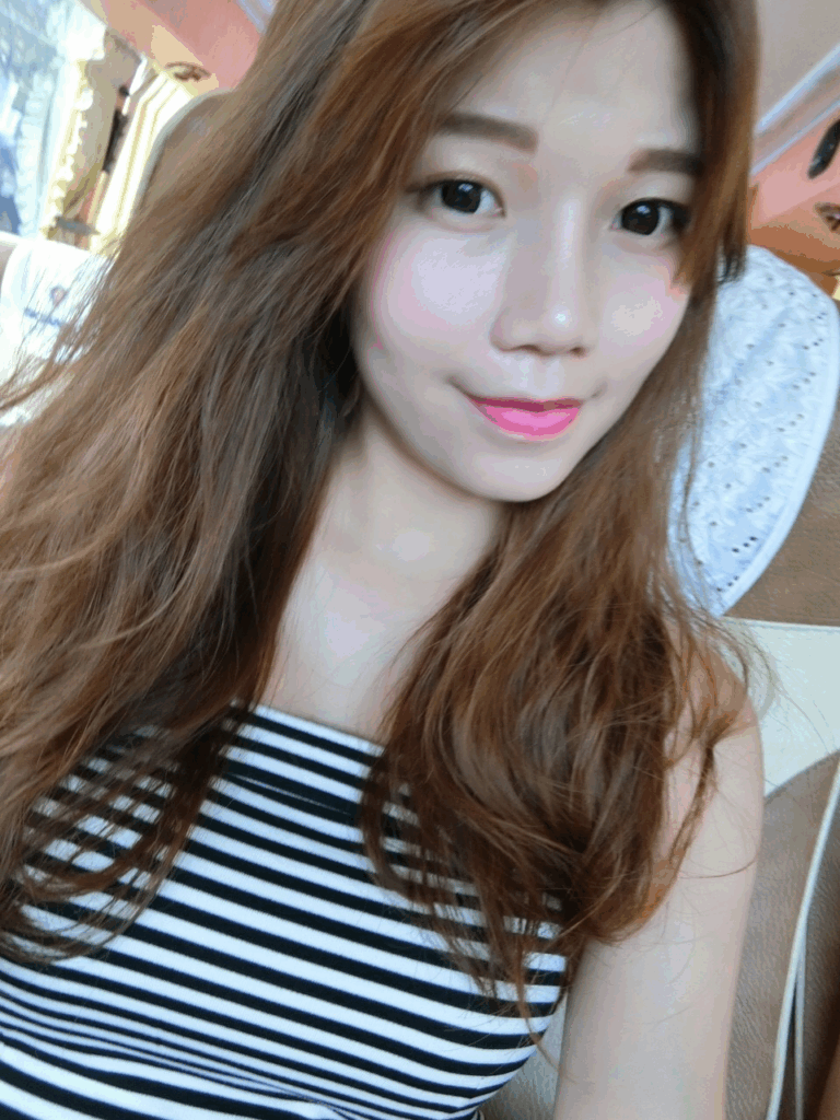 術後成果：宛如天生的自然美鼻2