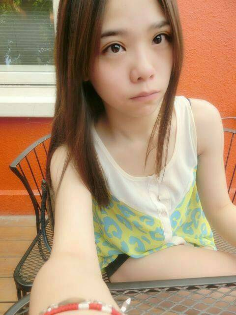 術前狀況：長期施打微晶瓷，導致山根擴散與扁塌1