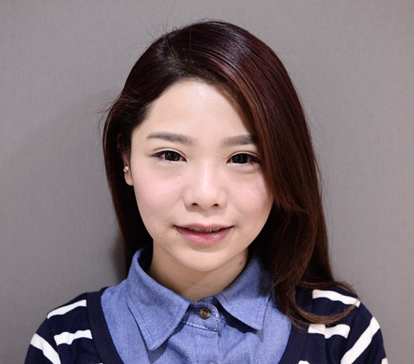 微晶瓷隆鼻的瓶頸：鼻樑變寬、鼻頭不夠精緻1