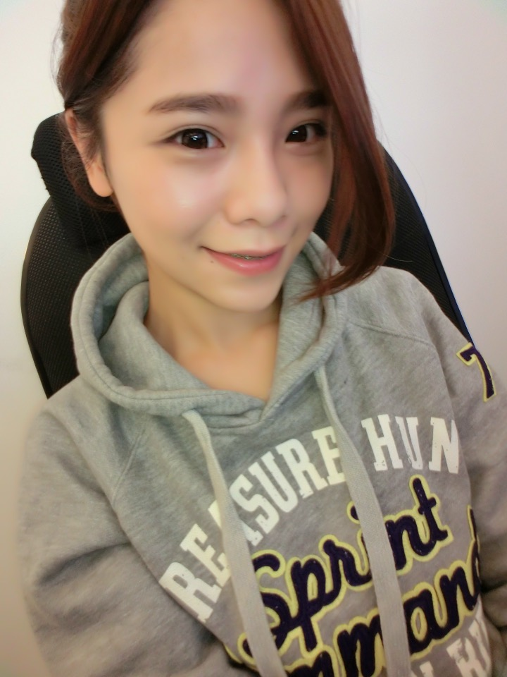 微晶瓷隆鼻的瓶頸：鼻樑變寬、鼻頭不夠精緻2