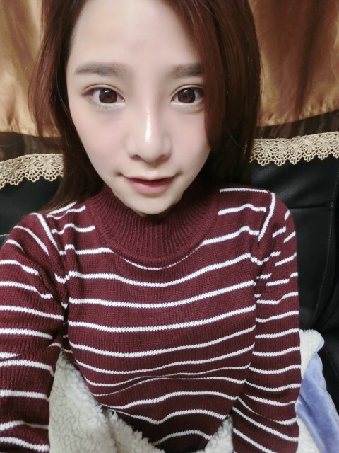 韓式隆鼻術後 7 天：微腫脹期，山根已顯高挺2