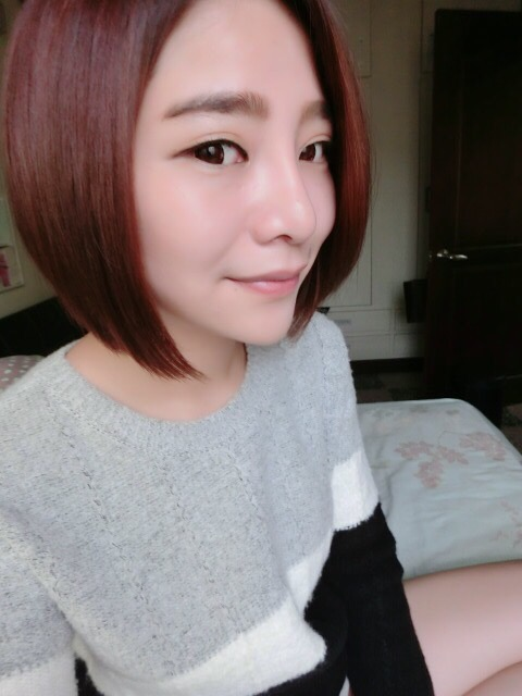 韓式隆鼻術後 1 個月：五官立體，時尚感大增2