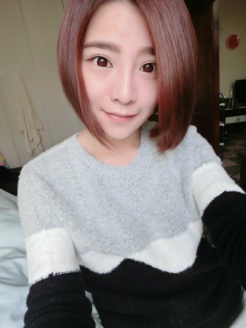 案例比對：微晶瓷隆鼻 vs. 韓式三段式隆鼻2