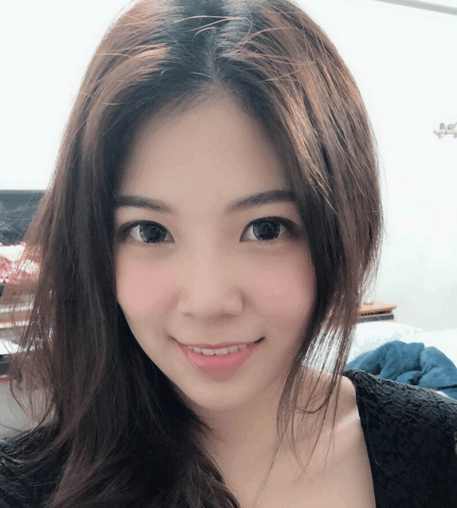 韓式隆鼻術後 3 個月對比：山根立體、五官精緻，打造零死角美鼻1