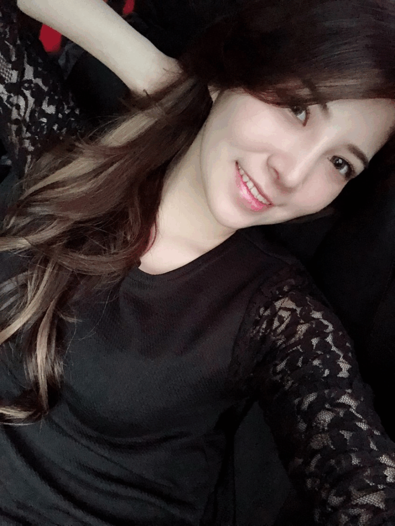 韓式隆鼻術後 3 個月對比：山根立體、五官精緻，打造零死角美鼻4