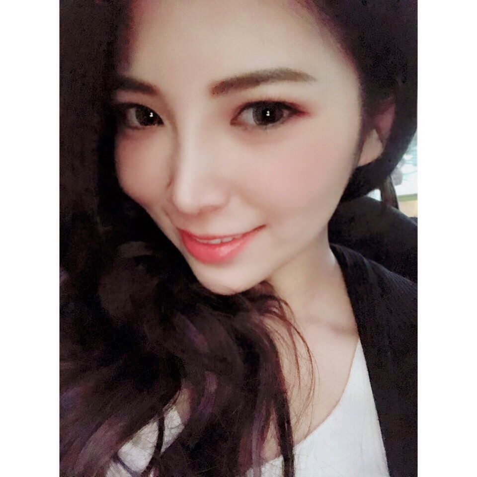 韓式隆鼻術後 3 個月對比：山根立體、五官精緻，打造零死角美鼻2