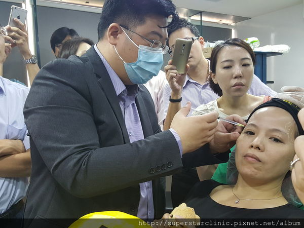 現場案例直擊：夫妻宮凹陷填補2