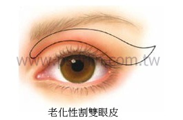 1. 是否有雙眼皮？