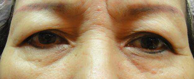 2. 眉眼間距是否足夠？1