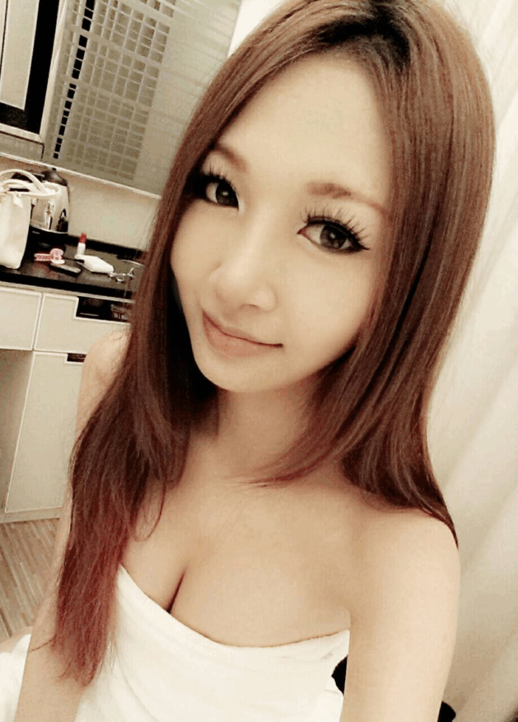 韓式隆鼻術後15天：恢復期短，鼻型自然顯著1