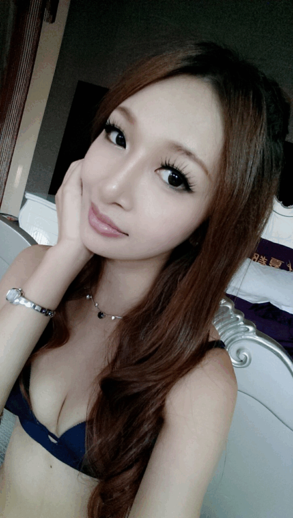 術後2個月：宛如天生的精緻微翹嘟嘟鼻2