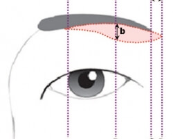 雙眼皮下垂只能用拉皮來解決?! 眉下拉皮 – 高階眼拉提手術 (一)