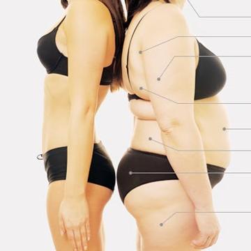 抽脂手術並非減重捷徑，而是針對局部頑固脂肪進行的「身體雕塑手術」