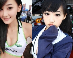 韓式隆鼻專題：結構式隆鼻與海鷗隆鼻案例全解析