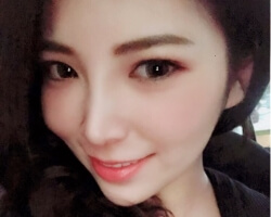 三段式隆鼻結構式隆鼻-–-以一體成形GoreTex鼻模打造自然完美鼻形