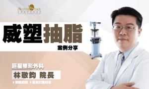巨星整形外科｜威塑環狀大腿抽脂案例：恩恩瘦腿雕塑、馬鞍臀改善更有感！