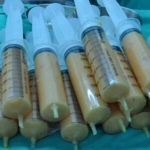 淺談自體脂肪隆乳