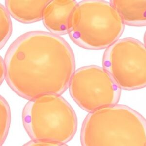 爆掛-自體脂肪隆乳不能說的秘密