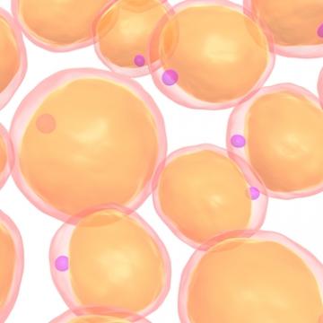 爆掛-自體脂肪隆乳不能說的秘密