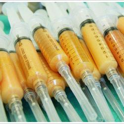 自體脂肪隆乳-–-隆乳費用合理-豐胸細腰一次完成