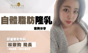 自體脂肪隆乳Q&A與案例分享