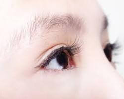 訂書針微創泡泡眼-案例-–-同步擺脫單眼皮與泡泡眼的困擾