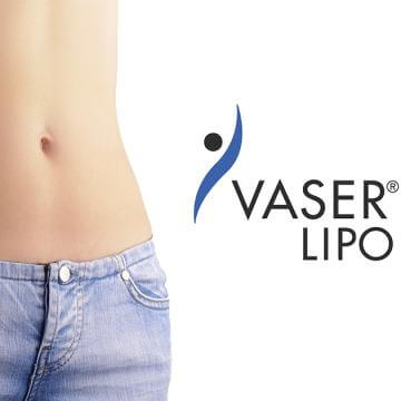 超音波 抽脂推薦-威塑和Ultra-Z的比較