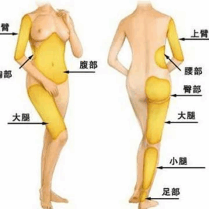 適合威塑抽脂的部位