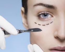 隱痕眼袋外開補淚溝