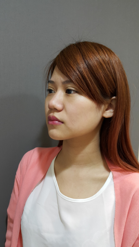 側面：鼻與額頭順接無斷層，鼻頭自然微翹