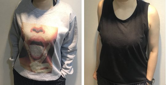 來到巨星醫美整形外科尋求林敬鈞醫師的專業協助，進行平胸手術