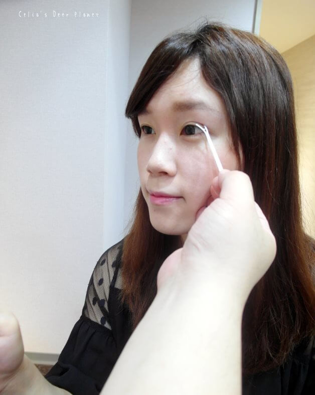 林敬鈞醫師專業諮詢：客製化桃花眼，看起來更有神，不追求比較誇張的開放式雙眼皮
