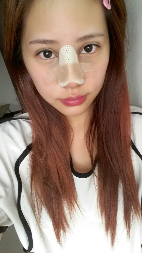 術後3天：固定與冰敷，腫脹在可控範圍