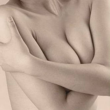 breast-33_1