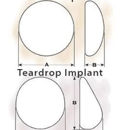 implant-18_0-1